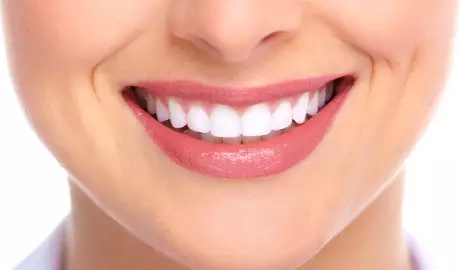 Cosmetisch tandheelkunde